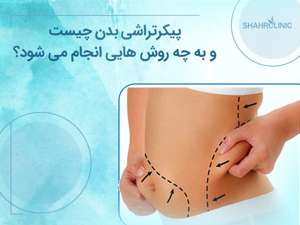 پیکر تراشی