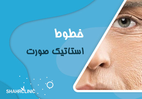 خطوط استاتیک صورت