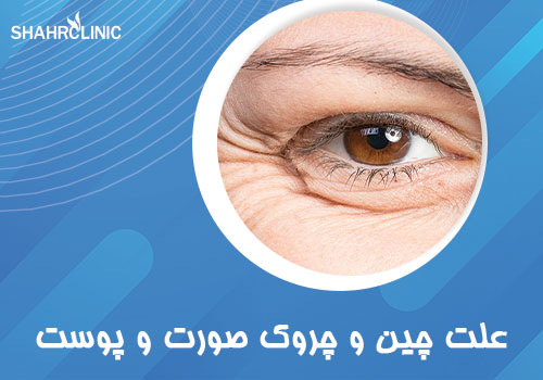 علت چین و چروک‌ صورت و پوست