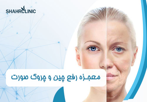 معجزه رفع چین و چروک صورت