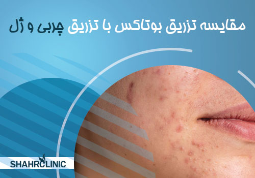 مقایسه تزریق بوتاکس با تزریق ژل و چربی