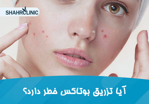 آیا تزریق بوتاکس برای جای جوش خطر دارد؟