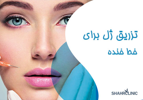 تزریق ژل لب برای خنده
