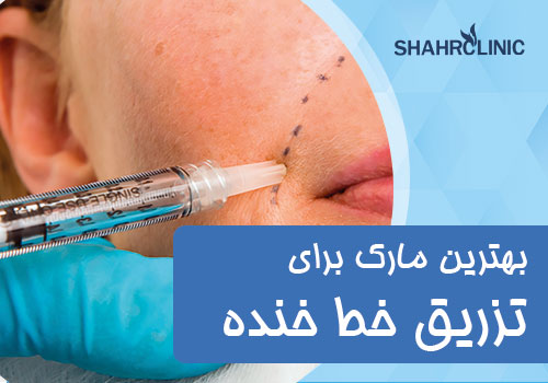 بهترین مارک ژل برای تزریق خط خنده