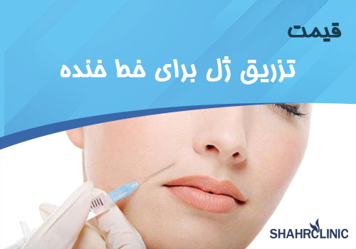 قیمت تزریق ژل برای خط خنده