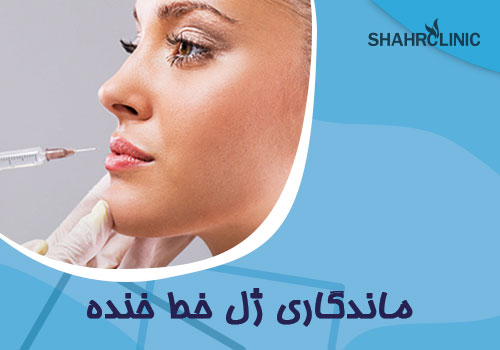 ماندگاری ژل خط خنده