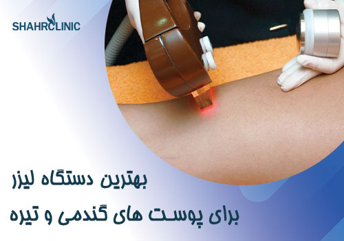 بهترین دستگاه لیزر برای پوست های گندمی،تیره و سبزه