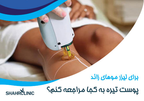 برای لیزر موهای زائد پوست سبزه به کجا مراجعه کنم؟