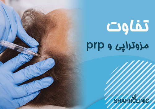مزوتراپی