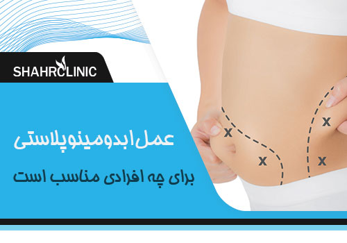 عمل ابدومینوپلاستی برای چه افرادی مناسب است؟