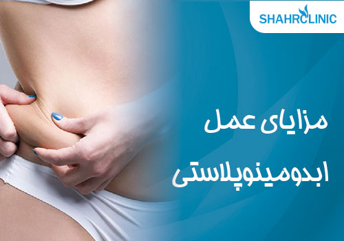 مزایای عمل ابدومینوپلاستی