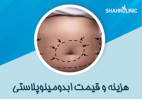 عمل ابدوپلاستی برای چه افرادی مناسب است