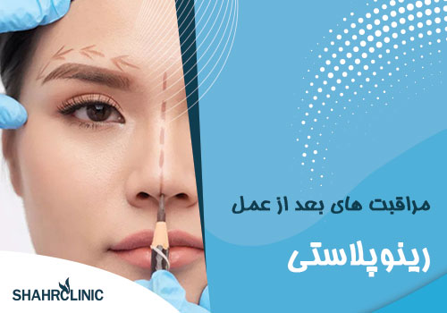 مراقبتهای بعد از عمل رینوپلاستی شامل چه مواردی میشود؟