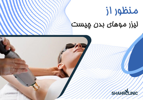 منظور از لیزر موی زائد