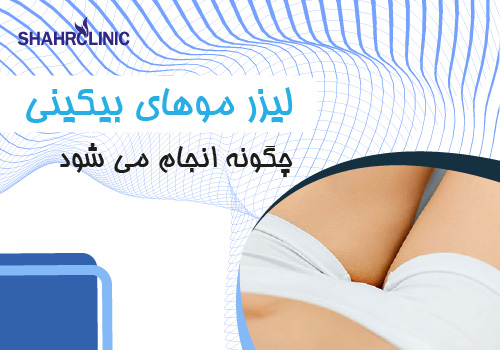 لیزر موهای زائد بیکینی چگونه انجام میشود؟