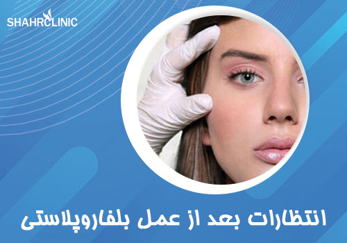 انتظاراتی که بلافاصله بعد از عمل بلفاروپلاستی میتوان داشت؟
