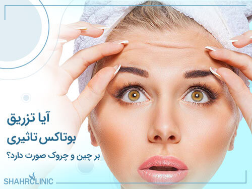 آیا تزریق بوتاکس تاثیری بر چین و چروک صورت دارد؟