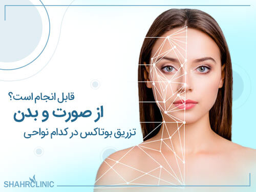 تزریق بوتاکس در کدام نواحی از صورت و بدن قابل انجام است؟
