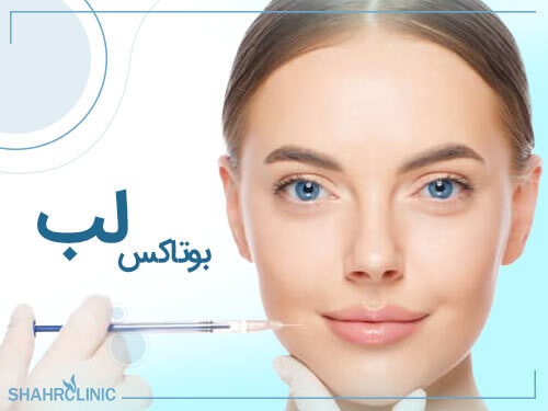 بوتاکس لب