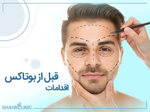 اقدامات قبل از بوتاکس
