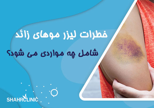 خطرات لیزر موهای زائد شامل چه مواردی میشود؟