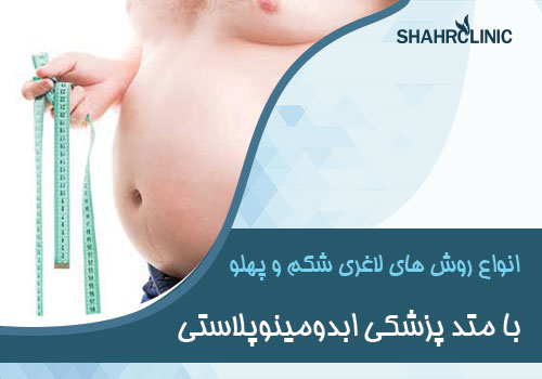 انواع روش های لاغری شکم و پهلو با متدهای پزشکی