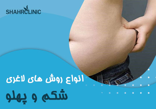 انواع روش های لاغری شکم و پهلو