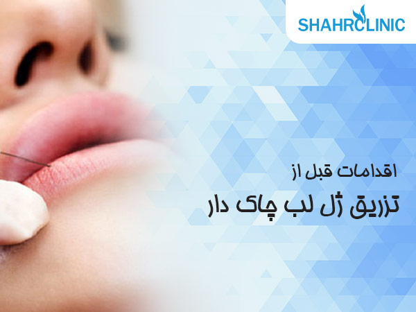 اقدامات قبل از تزریق ژل لب چاک دار