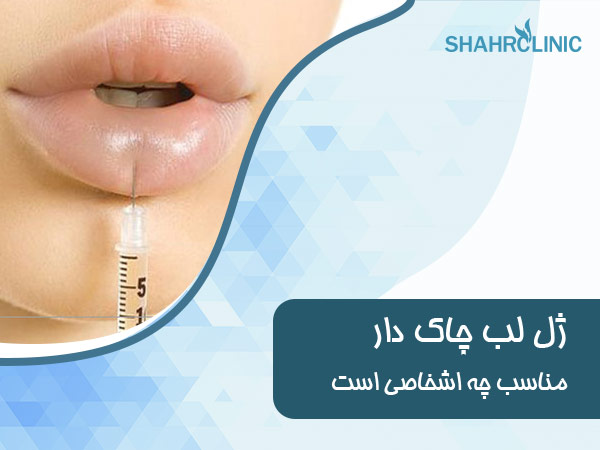 ژل لب مدل چاک دار مناسب چهره چه اشخاصی است
