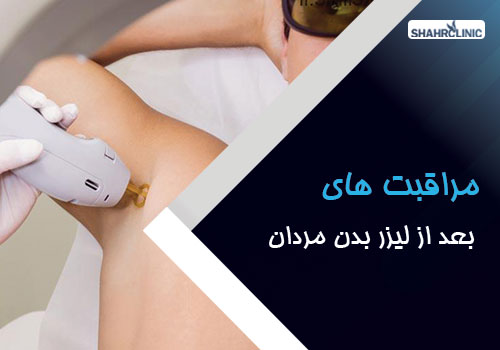 مراقبتهای بعد از لیزر موهای بدن مردان و انتظاراتی که باید داشت