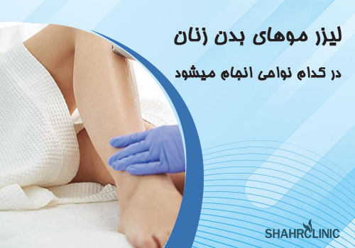 لیزر موهای بدن زنان در کدام نواحی انجام میشود؟