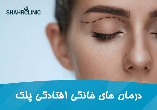 درمانهای خانگی و طبیعی افتادگی پلک