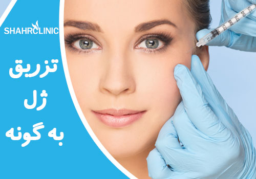 تزریق ژل به گونه
