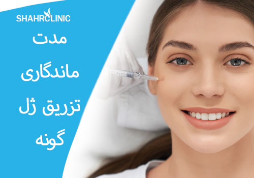 مدت ماندگاری تزریق ژل گونه