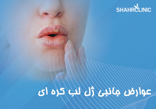 عوارض جانبی ژل لب کرهای