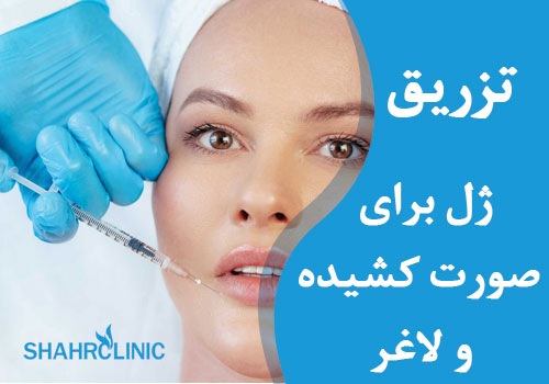 تزریق ژل برای صورت کشیده و لاغر