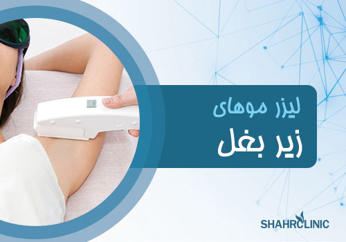 لیزر موهای زیر بغل
