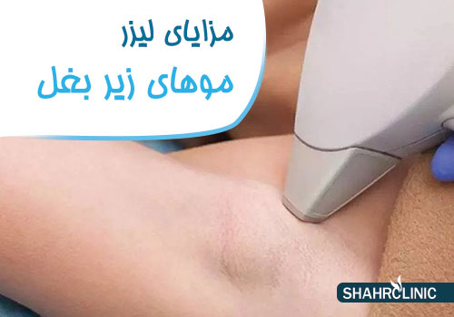 مزایای لیزر موهای زیر بغل