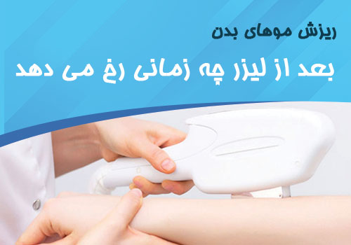 ریزش موهای بدن بعد از لیزر در چه زمانی رخ میدهد؟