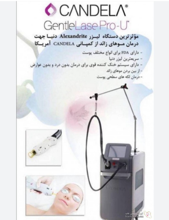 تصویر لیزر مو با الکس در شیراز 