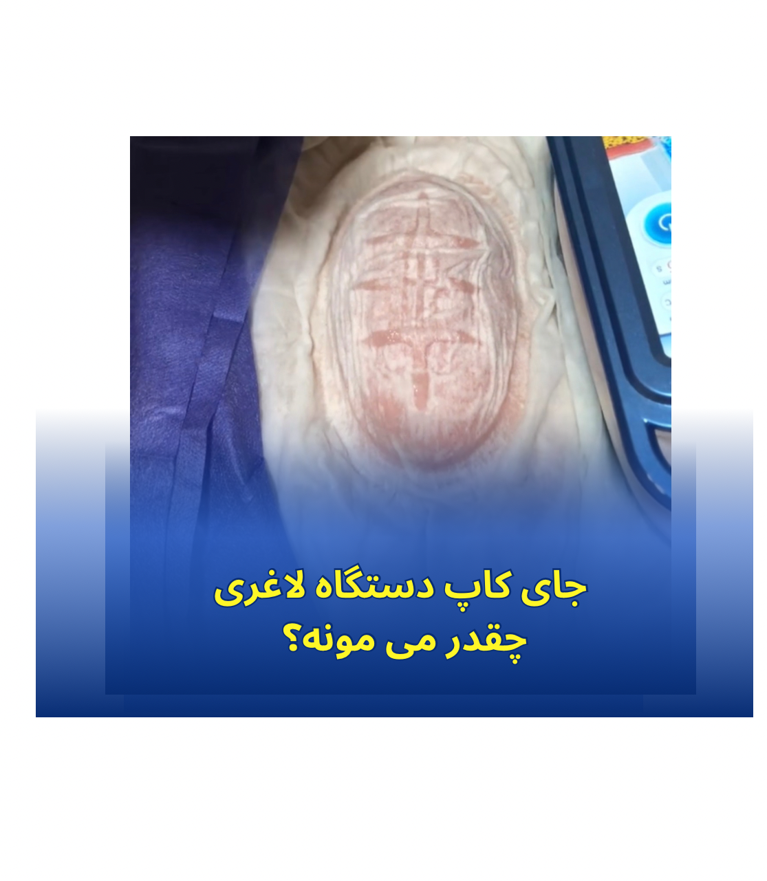 تصویر مرکز لاغری دلژین در مجیدیه جنوبی