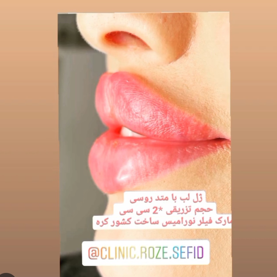 تصویر کلینیک زیبایی رز سفید اصفهان
