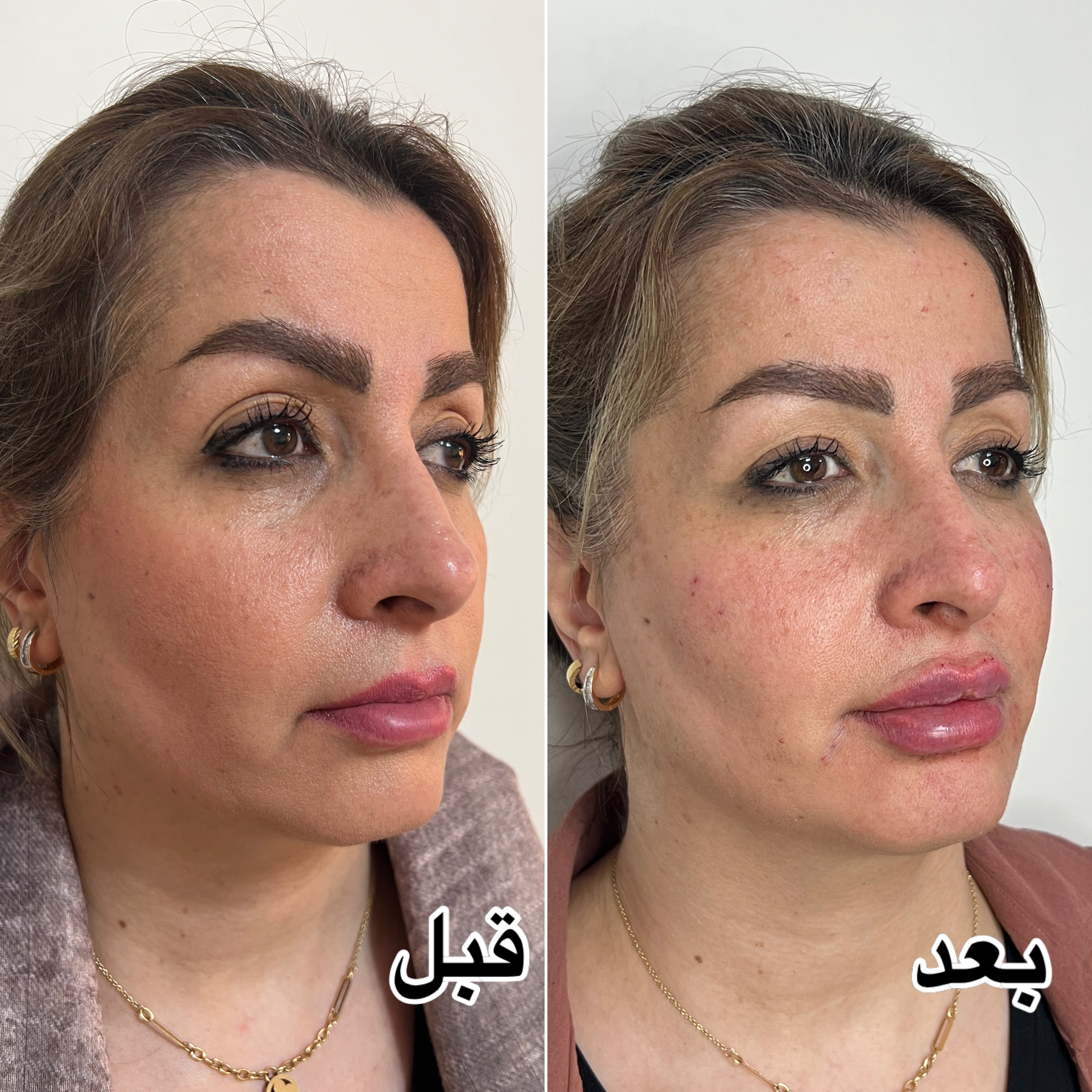 تصویر مرکز زیبایی و بوتاکس باران هروی