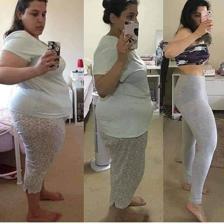 تصویر مطب لاغری در کرج