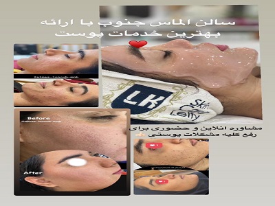 تصویر مرکز پاکسازی صورت میناب