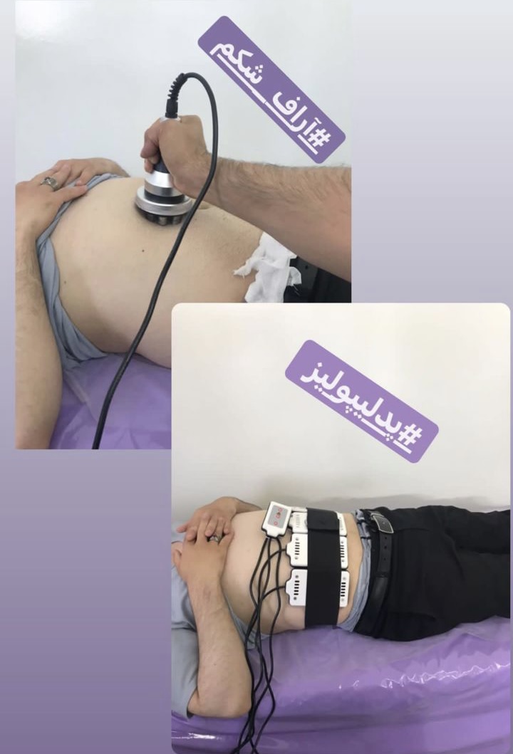 تصویر لاغری و رفع سلولیت در سراب