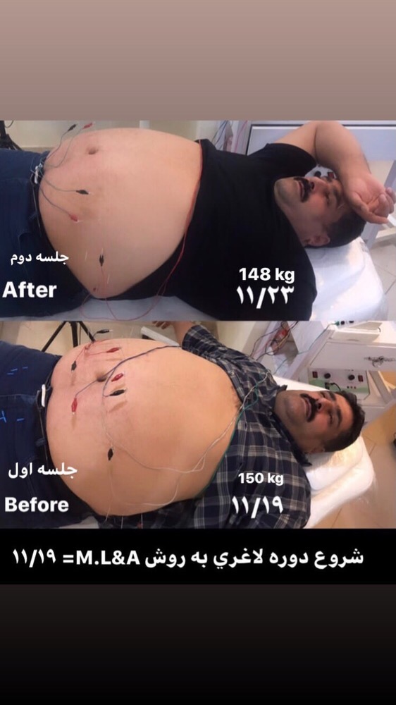 تصویر لاغری در گوهردشت کرج
